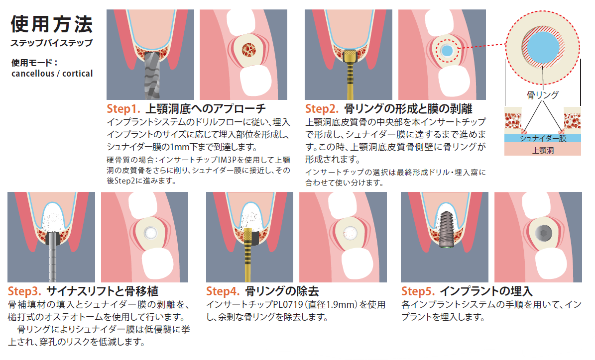 マニュアルピエゾリフトキット｜株式会社インプラテックスの取扱い商品